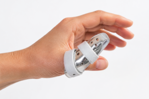 Splint for Trigger Thumb: Relief & Recovery Guide